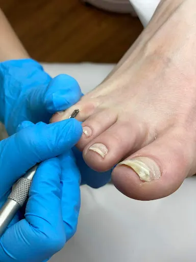 Feet Lab. Podologia, Akupunktura